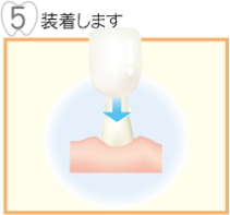 装着します