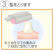 型をとります